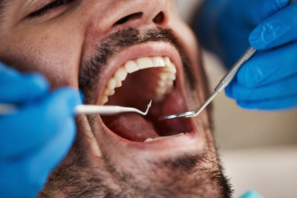 Best Emergency Root Canal Treatment in Epworth, IA